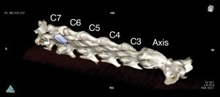Figure 6. 3D CT reconstruction of the equine cervical spine illustrating the synovial joint capsule and relationship with the nerve roots emanating from the ventral aspect of the vertebral body. Effusion of the joint capsule can result in impingement of the nerve roots, which at the level of C6 to T2 could result in gait abnormalities of the forelimbs.