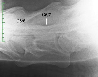 Figure 7. Contrast myelographic image of the caudal cervical spine showing greater than 40 per cent narrowing of the dorsal contrast column at C5/C6 and C6/C7. This horse exhibited hindlimb ataxia and hypermetria as its most obvious clinical signs.