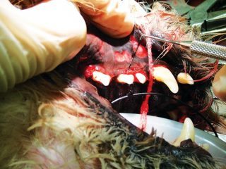 Figure 1. Severe gingivitis. When the probe was used to explore the furcation of this premolar, it passed all the way underneath the tooth. 