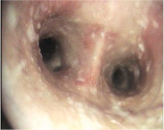 Figure 1. Tracheal mucopus in a horse affected with recurrent airway obstruction. Image: Tim Brazil.