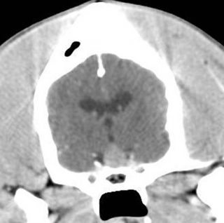 Figure 1. Transverse CT image post-contrast of the brain of a dog affected by a pituitary tumour.