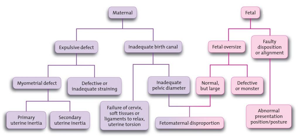 Causes of dystocia.