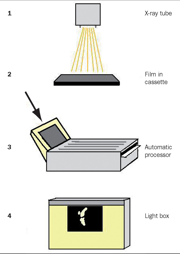 CONTRASTING VIEWS DIGITAL VS CONVENTIONAL RADIOGRAPHY Vet Times