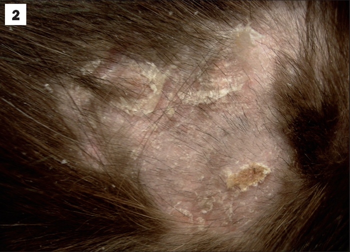 UNUSUAL SYNDROMES ASSOCIATED WITH CHEST NEOPLASIA IN FOCUS Vet Times