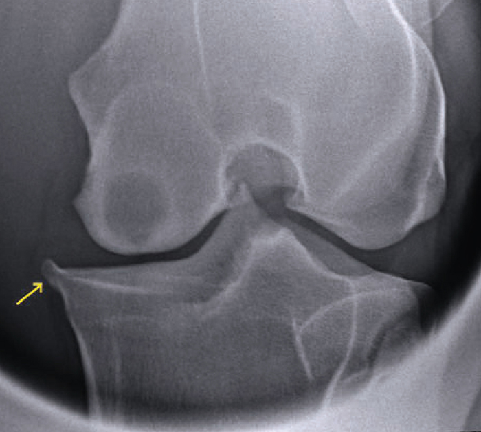 EQUINE OSTEOARTHRITIS MANAGEMENT OVER VIE W, OPTIONS AND TREATMENTS