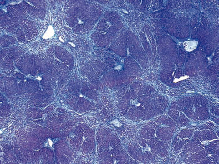 what is certified asbestos paintings