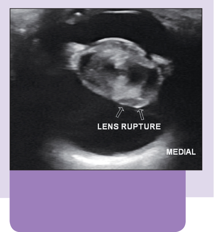 Cataract surgery Vet Times