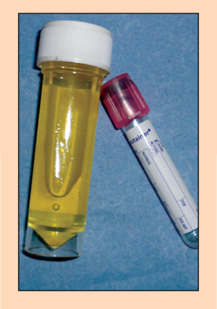 LEPTOSPIROSIS AN UPDATE Vet Times