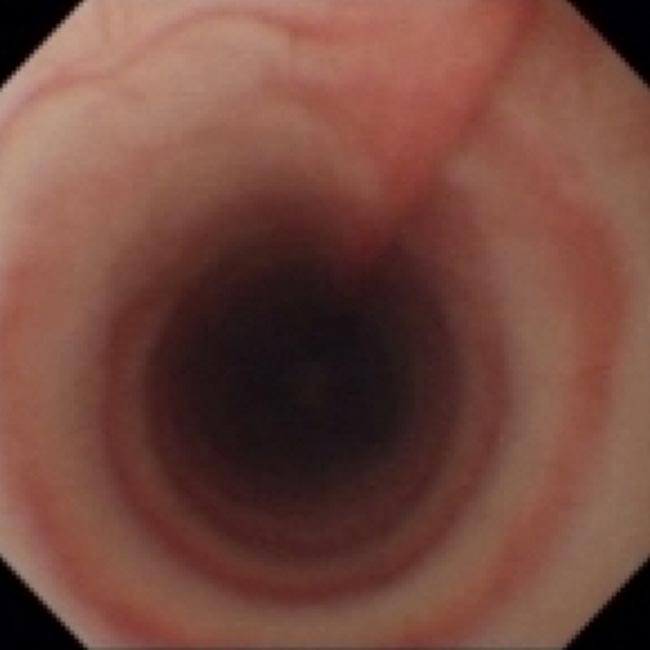 Figure 4. Normal canine trachea.