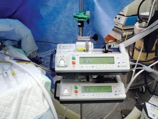 Figure 14. Ketamine and alfentanil infusions used in conjunction with general anaesthesia during spinal surgery.