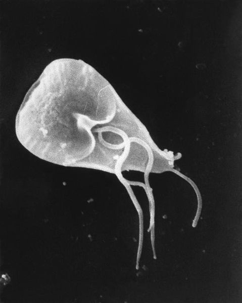 Can t get rid of giardia, Pinworms csiki - Sörte férgek