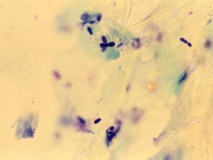 Tape cytology from dog with Malassezia dermatitis (Dif-Quik stain).