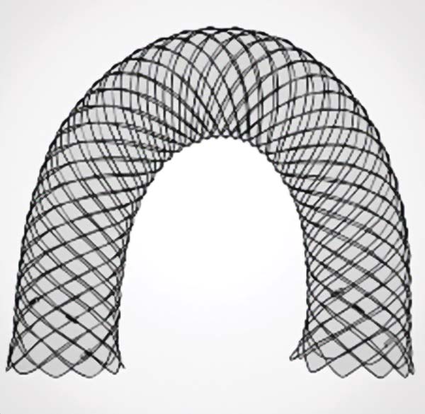 Figure 15. Illustration of a tracheal stent.
