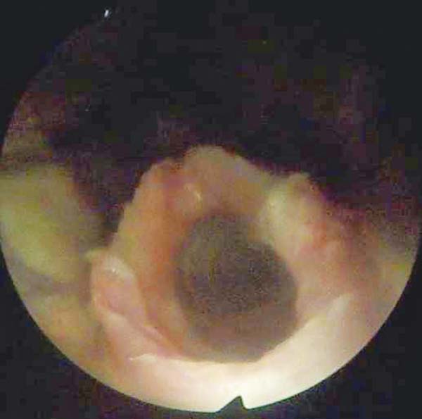 Figure 2. Close-up of a psittacine glottis.