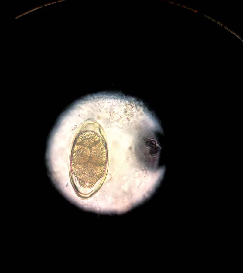 Figure 4. Syngamus trachea ova, seen under the microscope.