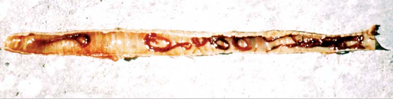 Figure 6. Syngamus trachea worms seen in the trachea of a dead bird.