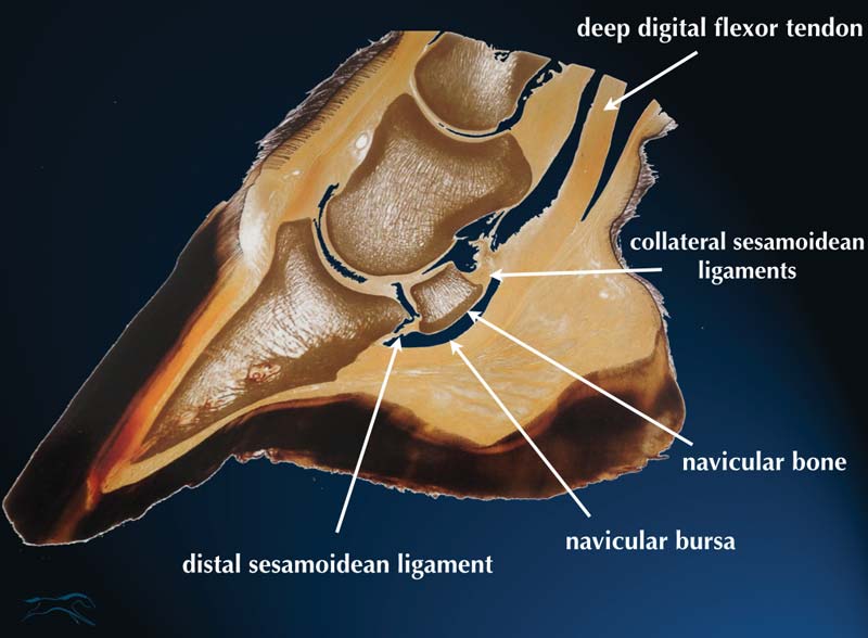 Figure 1. Sagittal cut of a specimen of a foot showing the structures forming the podotrochlear apparatus.