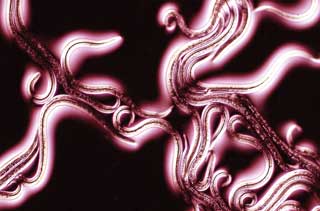 Figure 1. Larvae of A vasorum recovered from the faeces of an infected dog by using Baermann test. Larvae are typically 280µm to 330µm long. Image: Bayer Animal Health.