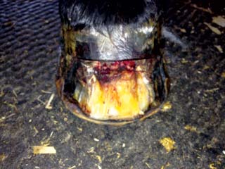 Figure 2. The foot in Figure 1 after resection. 