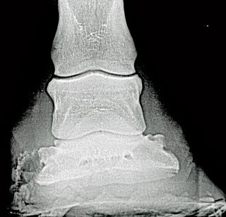 Figure 3. Dorsopalmar radiograph showing white line disease affecting from the lateral quarter to toe.
