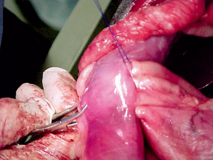 Gastric dilatation volvulus clearance surgery