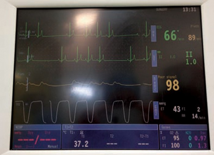 ADVANCED PATIENT MONITORING DURING ANAESTHESIA PART ONE Vet Times