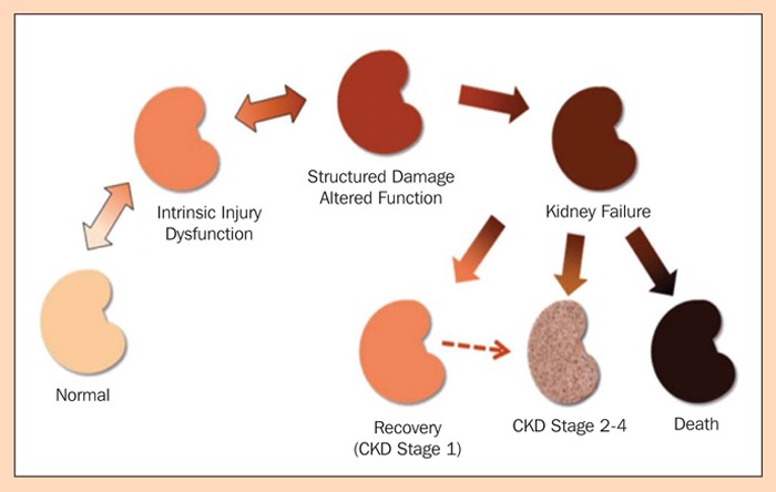 Acute kidney injury in cats part one – aetiology and prognosis | Vet Times