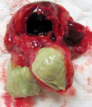 Figure 3. Severe case of chronic respiratory disease in a rat that developed pulmonary abscesses.