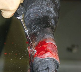 Figure 1. Thorough but gentle lavage, performed promptly using isotonic saline can be of enormous benefit.  