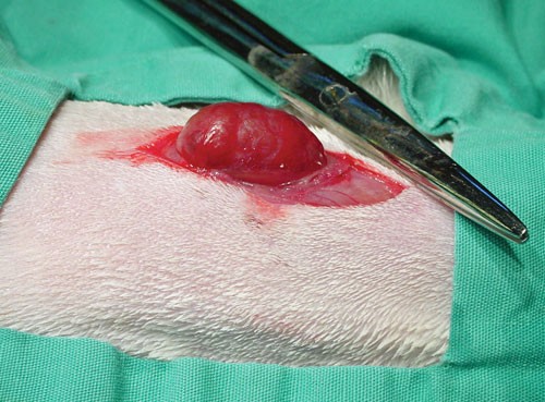 Surgical thyroidectomy