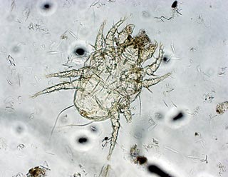 Figure 5. A Cheyletiella mite.