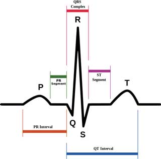 Figure 1. ECG showing cardiac conduction disturbances.