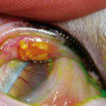 Figure 5. Eosinophilic eyelid infiltrate under the upper lid of an adult domestic short-hair. In this patient, the eyelid lesions were concurrent with eosinophilic corneal infiltrates. IMAGE: ©Christine Heinrich, Eye Vet Clinic.