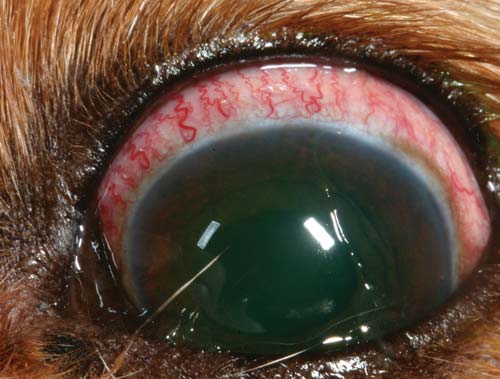 Figure 11. The presence of both conjunctival and episcleral/ciliary vessel hyperaemia is indicative of a disease mechanism involving not only the conjunctiva, but deeper ocular structures. In this patient, a uveitis is present as indicated by mild perilimbal corneal oedema, peripheral corneal vascularisation and peripheral iris thickening.