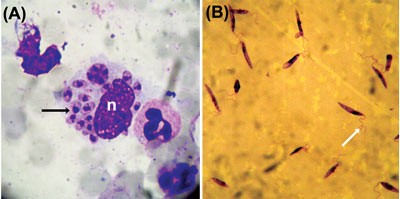 Leishmania lifecycle. Image: ©Najoua Haouas, Faculty of Pharmacy, Monastir, Tunisia.