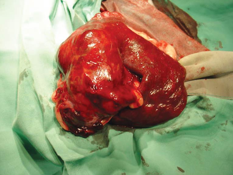 Figure 1. Spleen with haemangiosarcoma post-splenectomy. A provisional study suggests metronomic chemotherapy may have a role in improving survival compared to surgery alone.