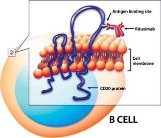 Figure 2. The canine anti-CD20 molecule similar to human rituximab acts by binding to the CD20 molecule on canine B-lymphocytes causing death by various mechanisms.  Hopefully, once more data is available, this will become a  standard therapy for canine B-cell lymphoma in combination with standard chemotherapy.