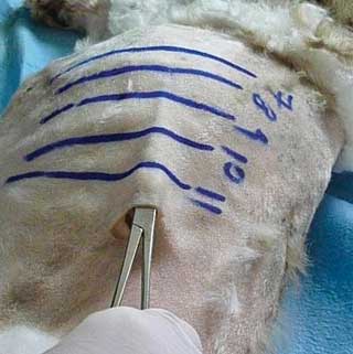 Figure 5b. Tunnelling provides a “flap valve” effect and limits iatrogenic entry of air into the pleural space along the tube’s surface.