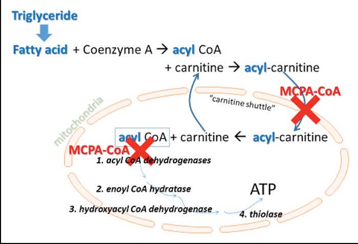 Figure 2. Pathophysiologic consequences of MCPA-CoA, the toxic product of hypoglycin A. Mitochondrial fatty acid oxidation is blocked in muscle cells.