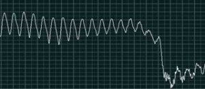 Figure 5b. An examples of an ECG recording from atypical myopathy cases: terminal ventricular fibrillation.