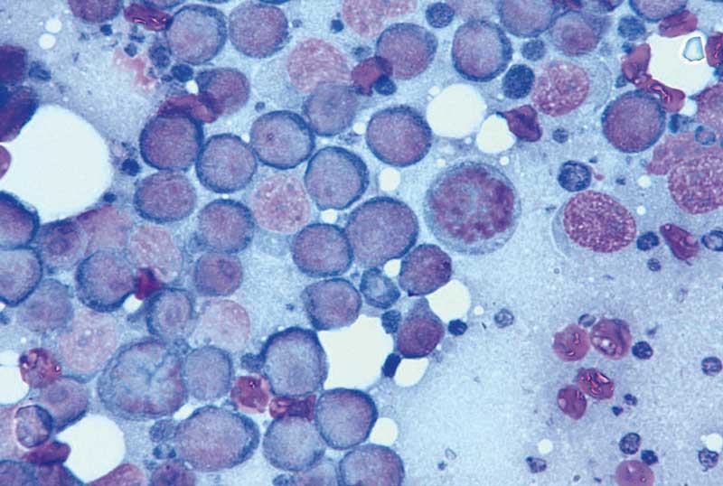 Figure 1. Lymphoma cytology. Lymph node fine-needle aspirate of a dog with typically high-grade/large cell lymphoma.