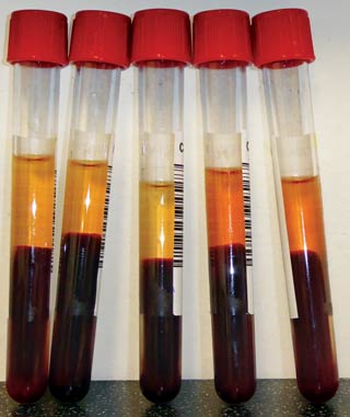 Figure 4. Serum samples from calves aged one to seven days to assess colostrum status.