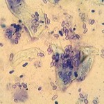Figure 7. Malassezia and Staphylococcus on cytology from an ear. Image: Susan Paterson.