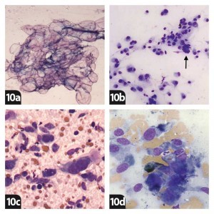 Figure 10. 10a. Lipoma. 10b. Perivascular wall tumour (the arrow indicates a crown cell. 10c. Fibrosarcoma. 10d. Melanoma.