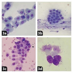 Figure 3. Examples of different types of epithelial cells. 3a. Squamous epithelial cells. 3b. Cuboidal epithelial cells. 3c. Non-ciliated columnar epithelial cells from a prostate. 3d. Ciliated columnar epithelial cells from the respiratory tract.