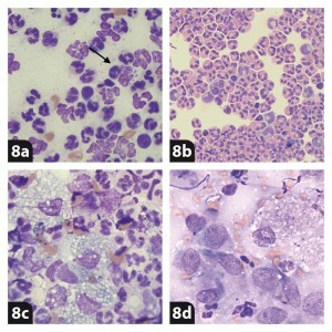 Figure 8. Examples of types of inflammation. 8a. Septic neutrophilic inflammation; neutrophils are degenerate and occasionally contain phagocytosed bacteria (arrow). 8b. Eosinophilic inflammation. 8c. Pyogranulomatous inflammation (mixture of neutrophils and activated macrophages). 8d. Granulomatous inflammation; macrophages contain numerous negative-stained rods consistent with Mycobacteria species.