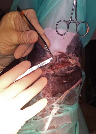 Figure 3. The use of sharp debridement under general anaesthesia to debride and decontaminate the wound.