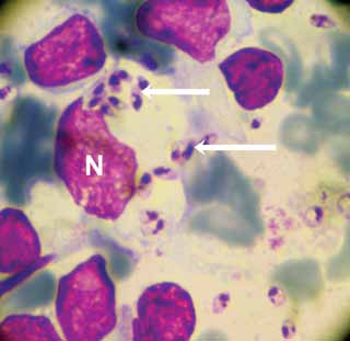 Figure 3. The intracellular, non-motile tissue stage of Leishmania amastigote. Note the presence of multiple amastigotes (white arrows) released from the cytoplasm of a macrophage (a special type of white blood cell). Abbreviation N: nucleus of the macrophage. Image: Najoua Haouas.