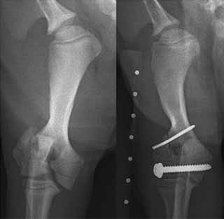 Figure 4. Craniocaudal radiographs of the humerus of a 15-week-old border terrier with a Salter-Harris type four fracture of the distal humeral condyle (left). This has been stabilised with a transcondylar lag screw and washer and a K-wire along the lateral epicondylar ridge (right).