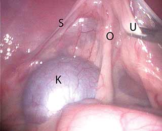 Figure 1. A laparoscopic view of the abdomen. K: kidney, S: suspensory ligament, O: ovary, U: uterus.